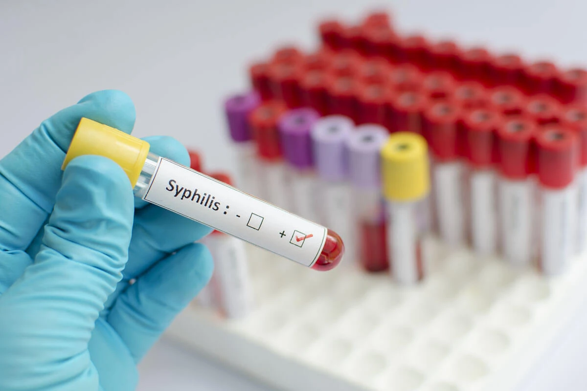 Die Syphilis geht um